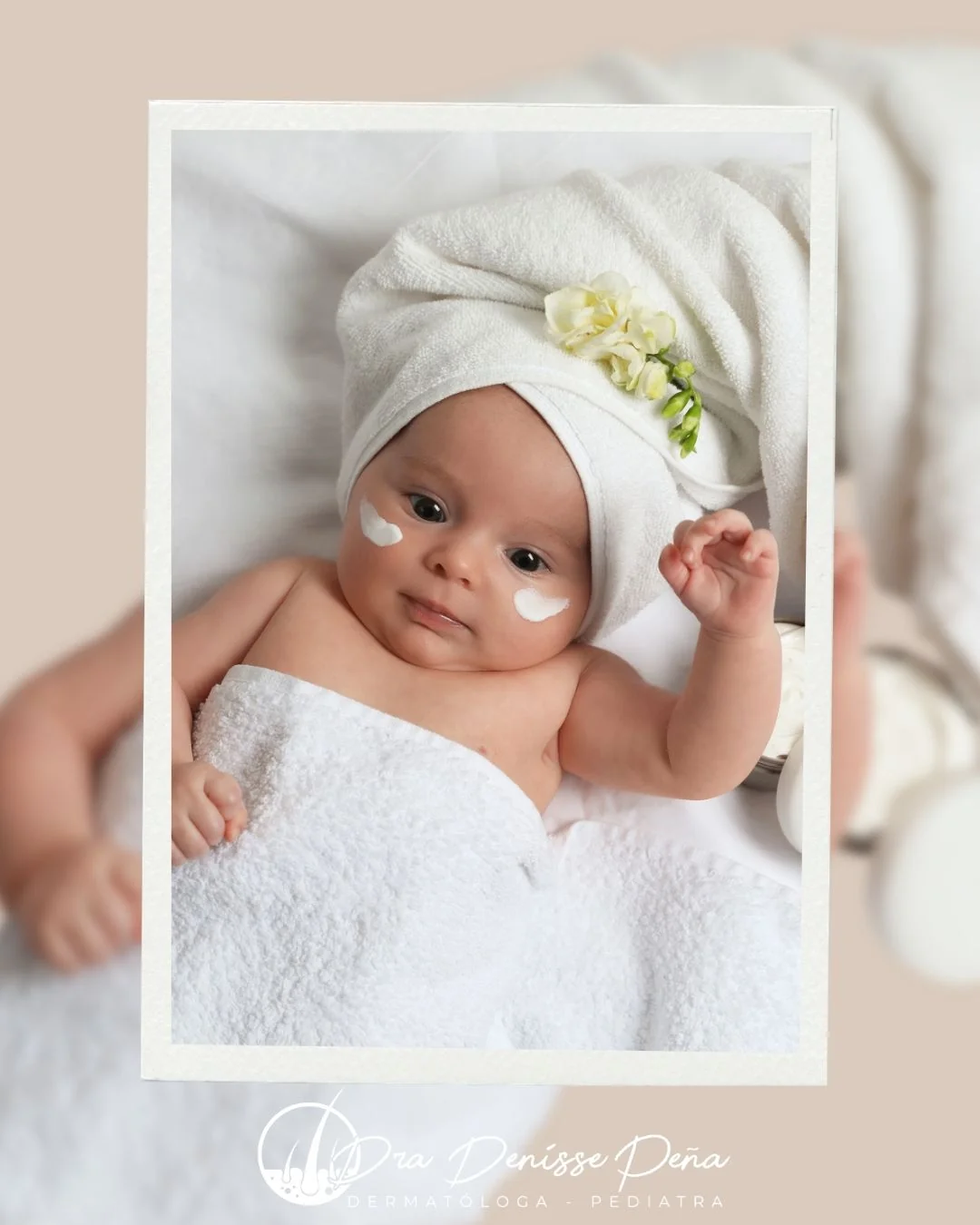 Bebé siendo atendido — dermatitis del pañal cuidados en casa